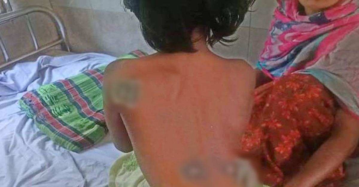 শিশুকে গরম খুন্তির ছ্যাঁকা, ভাবি গ্রেফতার