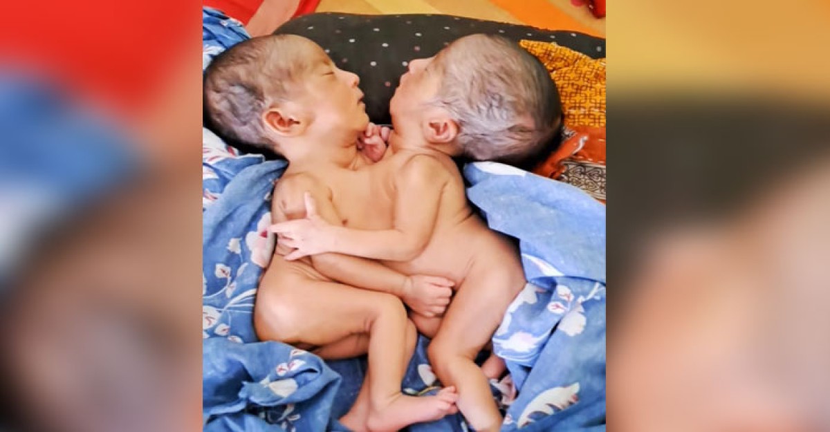 ত্রিশালে জোড়া শিশুর জন্ম