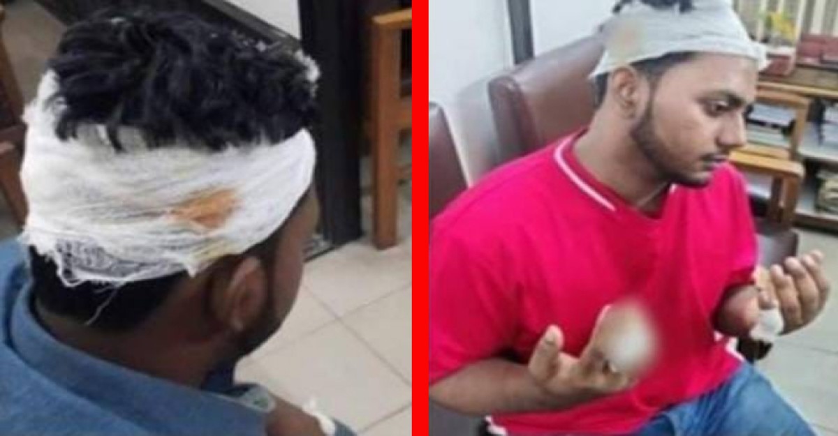 জবি শিক্ষার্থীদের ওপর হামলার ঘটনায় বনানী থানায় মামলা
