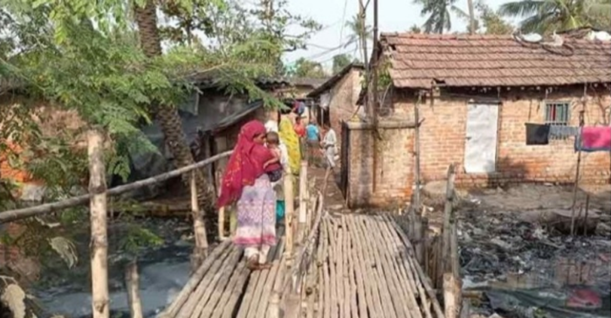 রাগে লিভ ইন পার্টনারের গোপনাঙ্গ কেটে দিল তরুণী