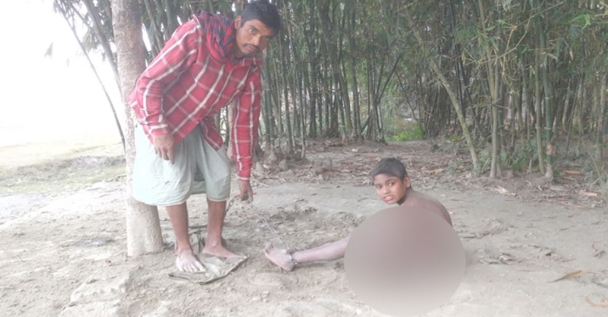শিকলে বাঁধা শিশু রাকিবের জীবন, অর্থাভাবে হচ্ছে না চিকিৎসা
